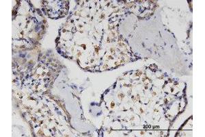 Image no. 1 for anti-Hematopoietic SH2 Domain Containing (HSH2D) (AA 251-353) antibody (ABIN599603) (HSH2D antibody  (AA 251-353))