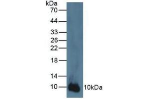Western blot analysis of Human A431 Cells. (S100A2 antibody  (AA 2-98))