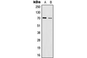 Western blot analysis of IL-17RC expression in HeLa (A), U251MG (B) whole cell lysates. (IL17RC antibody  (C-Term))