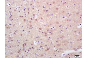 Formalin-fixed and paraffin embedded rat brain labeled with Rabbit Anti phospho-HSF1(Ser326) Polyclonal Antibody, Unconjugated (ABIN703466) at 1:200 followed by conjugation to the secondary antibody and DAB staining (HSF1 antibody  (pSer326))