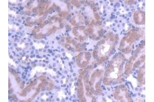 Detection of MTF1 in Mouse Kidney Tissue using Polyclonal Antibody to Metal Regulatory Transcription Factor 1 (MTF1) (MTF1 antibody  (AA 2-139))