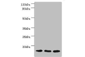 Western blot All lanes: Mitochondrial import receptor subunit TOM20 homolog antibody at 3 μg/mL Lane 1: Mouse brain tissue Lane 2: Hela whole cell lysate Lane 3: Mouse liver tissue Secondary Goat polyclonal to rabbit IgG at 1/10000 dilution Predicted band size: 16 kDa Observed band size: 16 kDa (TOMM2 (AA 20-145) antibody)