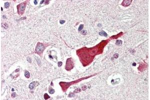 anti-BCL2-Like 10 (Apoptosis Facilitator) (BCL2L10) (N-Term) antibody