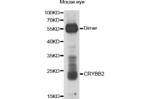 Western Blotting (WB) image for anti-Crystallin, beta B2 (CRYbB2) antibody (ABIN1876777) (CRYbB2 antibody)