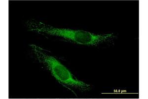 Immunofluorescence of monoclonal antibody to LSS on HeLa cell.