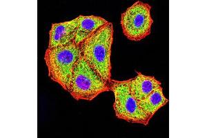 Immunocytochemistry (ICC) image for anti-V-Akt Murine Thymoma Viral Oncogene Homolog 3 (Protein Kinase B, Gamma) (AKT3) (AA 37-150) antibody (ABIN5542569)