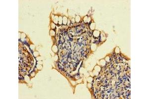 Immunohistochemistry of paraffin-embedded human small intestine tissue using ABIN7167939 at dilution of 1:100 (ARHGAP19 antibody  (AA 1-494))
