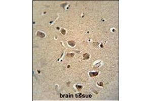 RAT SERPH Monoclonal Antibody (Center) (ABIN658998 and ABIN2838038) immunohistochemistry analysis in formalin fixed and paraffin embedded human brain tissue followed by peroxidase conjμgation of the secondary antibody and DAB staining. (SERPINH1 antibody  (AA 222-251))