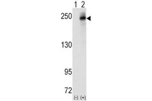 Western blot analysis of ALK antibody and 293 cell lysate (2 ug/lane) either nontransfected (Lane 1) or transiently transfected with the human gene (2). (ALK antibody  (AA 636-666))