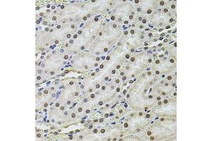 Immunohistochemistry of paraffin-embedded rat kidney using SET/T antibody (ABIN6131351, ABIN6147629, ABIN6147632 and ABIN6216153) at dilution of 1:100 (40x lens). (SET/TAF-I antibody  (AA 146-277))