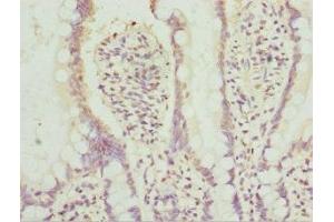 Immunohistochemistry of paraffin-embedded human small intestine tissue using ABIN7142022 at dilution of 1:100 (AGPAT2 antibody  (AA 199-278))