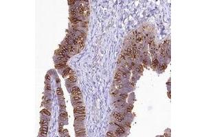 Immunohistochemical staining of human fallopian tube with LRRC34 polyclonal antibody  shows strong cytoplasmic and membrane positivity in glandular cells. (LRRC34 antibody)