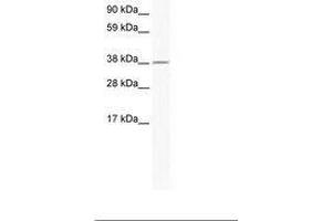 RNF130 anticorps  (AA 44-93)