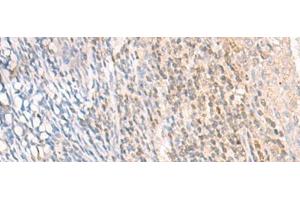 Immunohistochemistry of paraffin-embedded Human tonsil tissue using EPSTI1 Polyclonal Antibody at dilution of 1:25(x200) (EPSTI1 antibody)