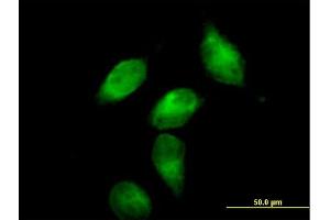 Immunofluorescence of purified MaxPab antibody to SERPINA3 on HeLa cell.