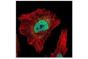 ICC/IF Image Confocal immunofluorescence analysis (Olympus FV10i) of paraformaldehyde-fixed HeLa, using Tankyrase 2, antibody (Green) at 1:500 dilution. (TNKS2 antibody  (N-Term))