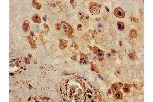 Immunohistochemistry of paraffin-embedded human placenta tissue using ABIN7162445 at dilution of 1:100 (P2RX4 antibody  (AA 91-176))