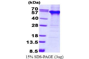 SDS-PAGE (SDS) image for Thymine-DNA Glycosylase (TDG) protein (His tag) (ABIN1098673) (TDG Protein (His tag))
