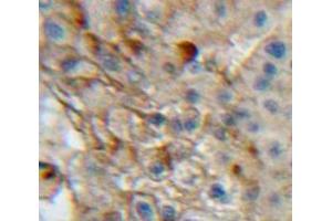 Used in DAB staining on fromalin fixed paraffin-embedded Liver tissue (Integrin alpha 1 antibody  (AA 125-366))