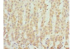 Immunohistochemistry of paraffin-embedded human adrenal gland tissue using ABIN7166101 at dilution of 1:100 (SCO2 antibody  (AA 1-130))