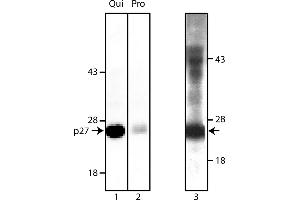 Western Blotting (WB) image for anti-Cyclin-Dependent Kinase Inhibitor 1B (p27, Kip1) (CDKN1B) antibody (ABIN967391) (CDKN1B antibody)