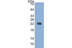 WB of Protein Standard: different control antibodies against Highly purified E. (CYFRA21.1 CLIA Kit)