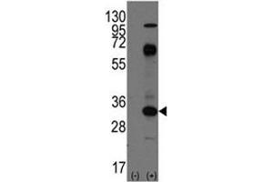 Western blot analysis of CD8 antibody and 293 cell lysate (2 ug/lane) either nontransfected (Lane 1) or transiently transfected with the CD8A gene (2). (CD8 alpha antibody  (AA 150-180))