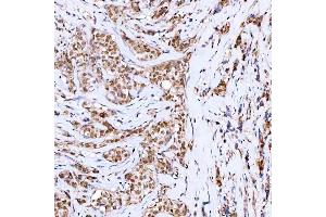 IHC analysis of Symplekin/SYMPK using anti-Symplekin/SYMPK antibody (ABIN7601558). (Symplekin antibody  (AA 384-1092))