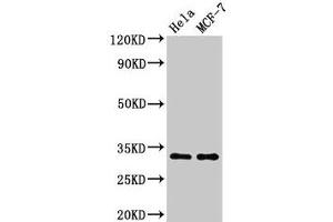 Western Blot Positive WB detected in: Hela whole cell lysate, MCF-7 whole cell lysate All lanes: HIST1H1B antibody at 1. (Histone H1.5 antibody  (pThr154))