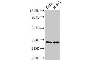 Western Blot Positive WB detected in: Hela whole cell lysate, MCF-7 whole cell lysate All lanes: HIST1H1B antibody at 1.