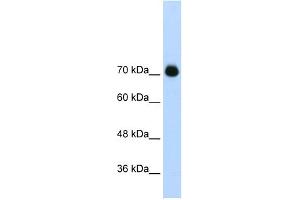 WB Suggested Anti-GTF2IRD1 Antibody Titration:  2. (GTF2IRD1 antibody  (C-Term))