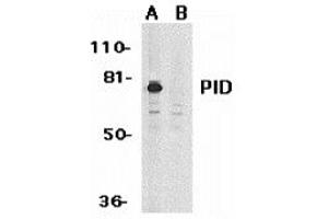 Western blot analysis of PID expression in HeLa whole cell lysates in the absence (A) or presence (B) of blocking peptide with PID antibody at 1 ug /ml. (MTA2 antibody)