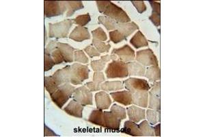 CFB Antibody (Center) (ABIN652979 and ABIN2842621) immunohistochemistry analysis in formalin fixed and paraffin embedded human skeletal muscle followed by peroxidase conjugation of the secondary antibody and DAB staining. (Complement Factor B antibody  (AA 469-494))