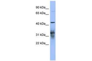 Image no. 1 for anti-Poly(A) Binding Protein, Cytoplasmic 5 (PABPC5) (AA 71-120) antibody (ABIN6743042)