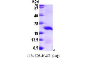 Calcium Regulated Heat Stable Protein 1, 24kDa (CARHSP1) (AA 1-147) protein (His tag)