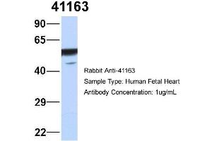 Host: Rabbit   Target Name: 41163   Sample Tissue: Human Fetal Heart  Antibody Dilution: 1. (Septin 11 antibody  (N-Term))