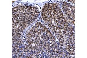 IHC analysis of MLH1 using anti-MLH1 antibody (ABIN7599691).