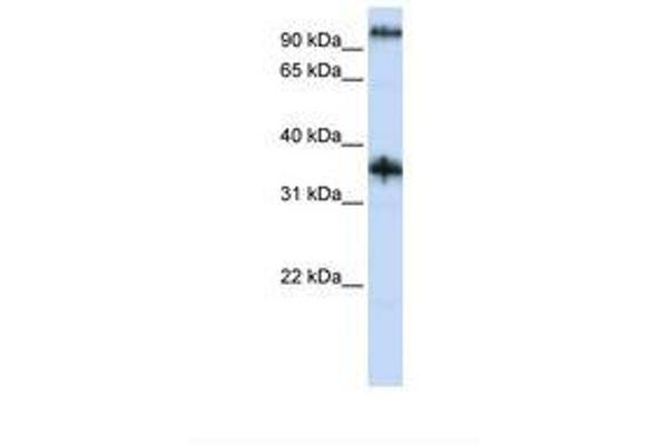 Ferric-Chelate Reductase 1 Like (FRRS1L) (AA 74-123) 抗体