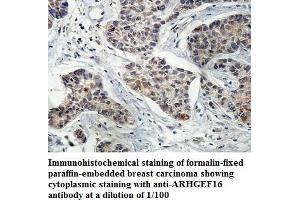 Image no. 1 for anti-rho Guanine Nucleotide Exchange Factor (GEF) 16 (ARHGEF16) antibody (ABIN1574807) (ARHGEF16 antibody)