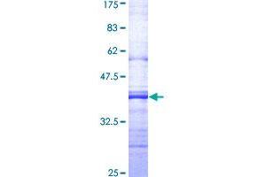 SIAH2 Protein (AA 225-324) (GST tag)