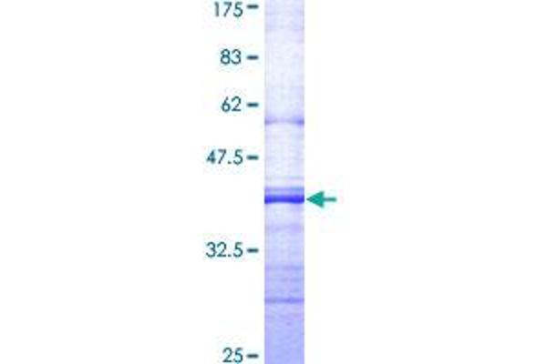 SIAH2 Protein (AA 225-324) (GST tag)