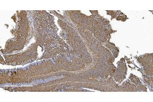 IHC analysis of PLTP using anti-PLTP antibody (ABIN7600346). (PLTP antibody  (AA 18-470))