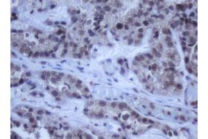 Image no. 2 for anti-DEAD (Asp-Glu-Ala-Asp) Box Polypeptide 59 (DDX59) (AA 1-303) antibody (ABIN1490728) (DDX59 antibody  (AA 1-303))
