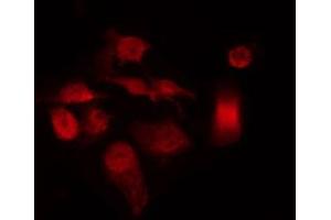 ABIN6267586 staining HeLa by IF/ICC. (E2F1 antibody  (pThr433))
