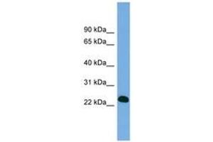 Image no. 1 for anti-B-Cell CLL/lymphoma 7A (BCL7A) (AA 71-120) antibody (ABIN6743279) (BCL7A antibody  (AA 71-120))