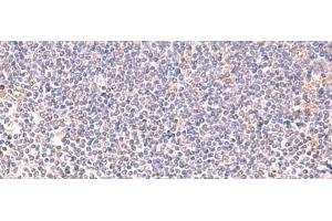 Immunohistochemistry of paraffin-embedded Human tonsil tissue using DHPS Polyclonal Antibody at dilution of 1:75(x200) (DHPS antibody)