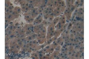 Immunohistochemistry (IHC) image for anti-Apolipoprotein C-I (APOC1) (AA 31-83) antibody (ABIN7431446)
