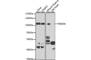 Western blot analysis of extracts of various cell lines, using TNNI3K antibody (ABIN6132847, ABIN6149361, ABIN6149362 and ABIN6223764) at 1:1000 dilution. (TNNI3K antibody  (AA 1-75))