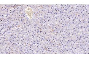 Detection of APOH in Human Liver Tissue using Monoclonal Antibody to Apolipoprotein H (APOH) (APOH antibody  (AA 22-345))