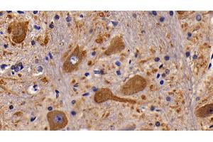 Detection of CHRM1 in Rat Spinal cord Tissue using Polyclonal Antibody to Cholinergic Receptor, Muscarinic 1 (CHRM1) (CHRM1 antibody  (AA 210-363))